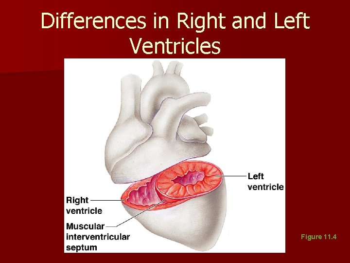 Differences in Right and Left Ventricles Figure 11. 4 Differences in Right and Left Ventricles Figure 11. 4