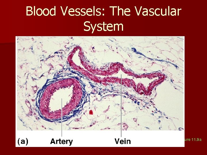 Blood Vessels: The Vascular System Figure 11. 9 a Blood Vessels: The Vascular System Figure 11. 9 a