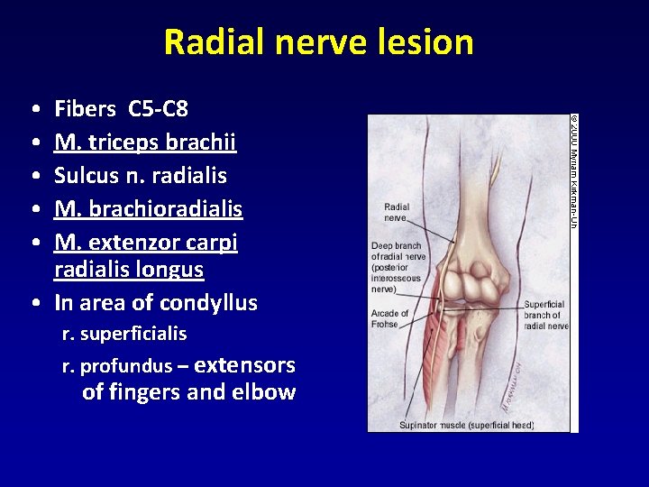 Radial nerve lesion • • • Fibers C 5 -C 8 M. triceps brachii Radial nerve lesion • • • Fibers C 5 -C 8 M. triceps brachii