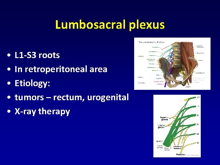 Lumbosacral plexus • • • L 1 -S 3 roots In retroperitoneal area Etiology: Lumbosacral plexus • • • L 1 -S 3 roots In retroperitoneal area Etiology: