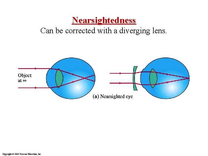 Nearsightedness Can be corrected with a diverging lens. Copyright © 2009 Pearson Education, Inc.