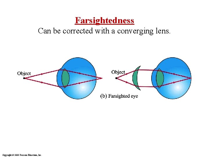 Farsightedness Can be corrected with a converging lens. Copyright © 2009 Pearson Education, Inc. Farsightedness Can be corrected with a converging lens. Copyright © 2009 Pearson Education, Inc.