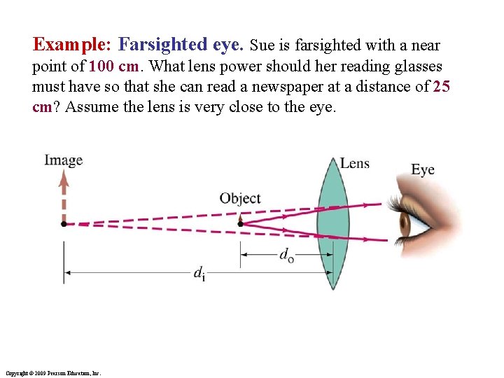 Example: Farsighted eye. Sue is farsighted with a near point of 100 cm. What