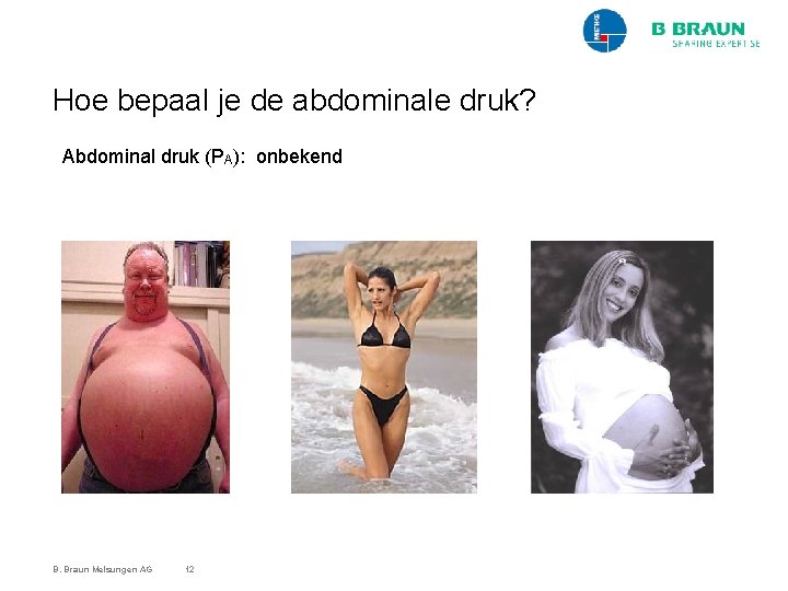 Hoe bepaal je de abdominale druk? Abdominal druk (PA): onbekend B. Braun Melsungen AG