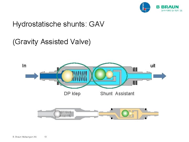 Hydrostatische shunts: GAV (Gravity Assisted Valve) In uit DP klep B. Braun Melsungen AG