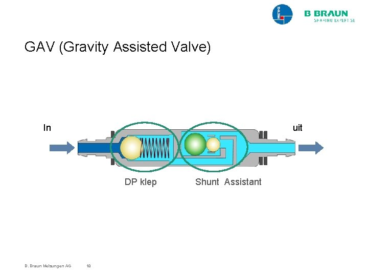 GAV (Gravity Assisted Valve) In uit DP klep B. Braun Melsungen AG 18 Shunt