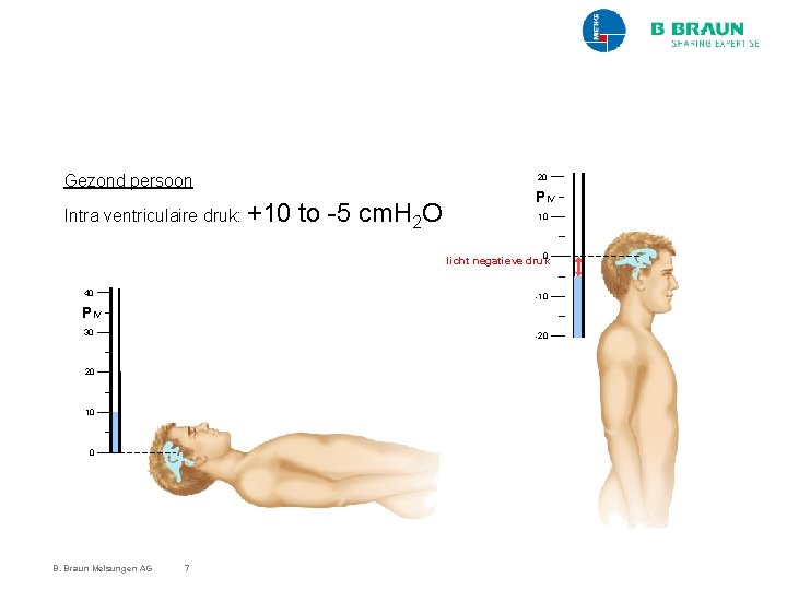 Gezond persoon Intra ventriculaire druk: +10 20 to -5 cm. H 2 O PIV