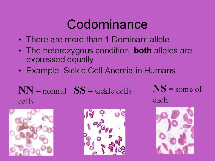 Codominance • There are more than 1 Dominant allele • The heterozygous condition, both