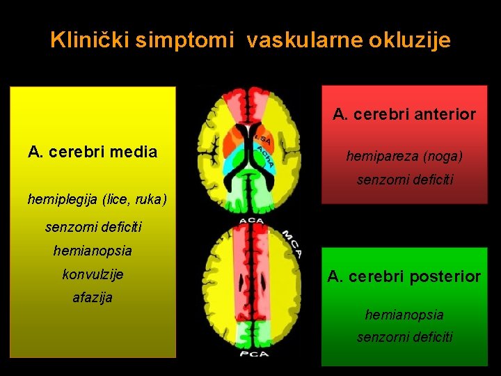 Klinički simptomi vaskularne okluzije A. cerebri anterior A. cerebri media hemipareza (noga) senzorni deficiti