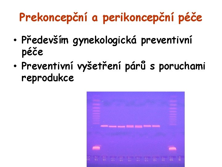 Prekoncepční a perikoncepční péče • Především gynekologická preventivní péče • Preventivní vyšetření párů s