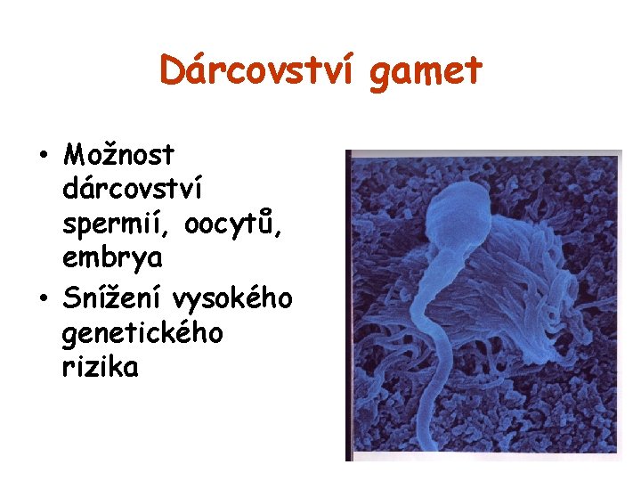 Dárcovství gamet • Možnost dárcovství spermií, oocytů, embrya • Snížení vysokého genetického rizika 