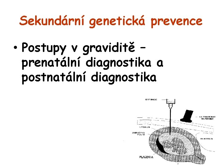 Sekundární genetická prevence • Postupy v graviditě – prenatální diagnostika a postnatální diagnostika 