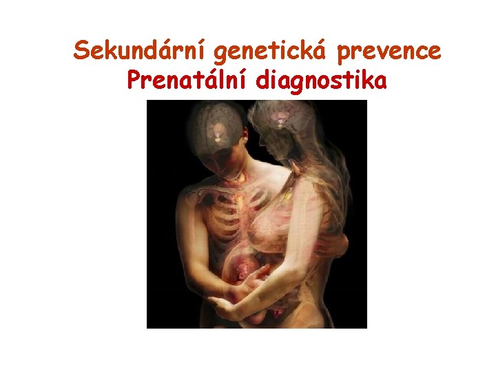 Sekundární genetická prevence Prenatální diagnostika 