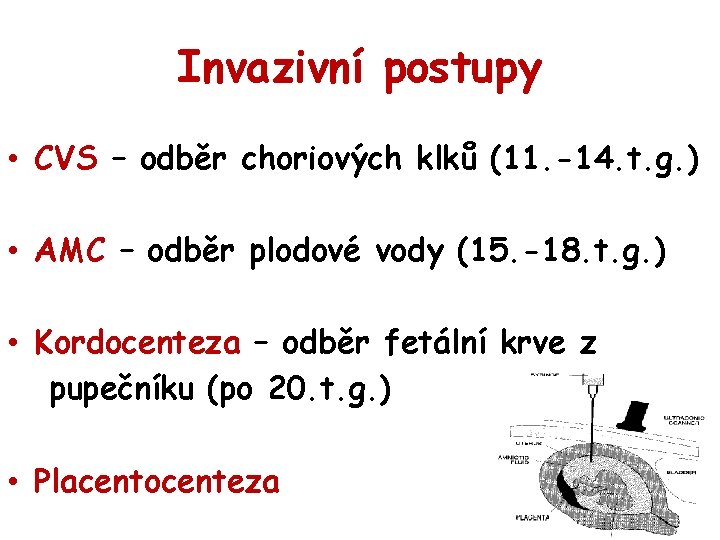 Invazivní postupy • CVS – odběr choriových klků (11. -14. t. g. ) •