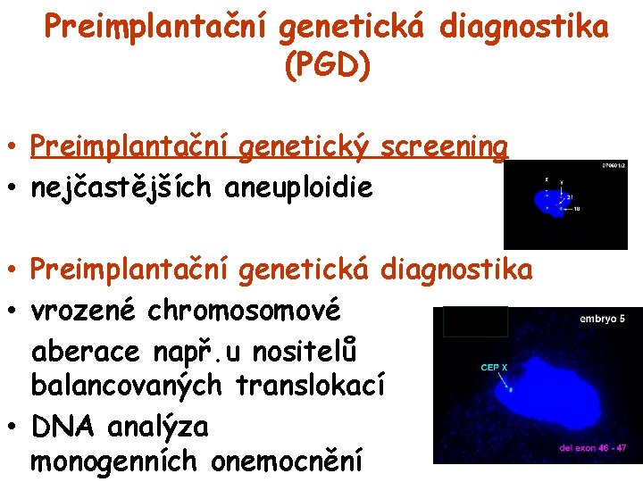 Preimplantační genetická diagnostika (PGD) • Preimplantační genetický screening • nejčastějších aneuploidie • Preimplantační genetická