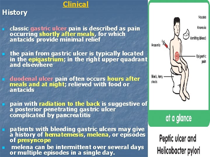 History n n n Clinical classic gastric ulcer pain is described as pain occurring