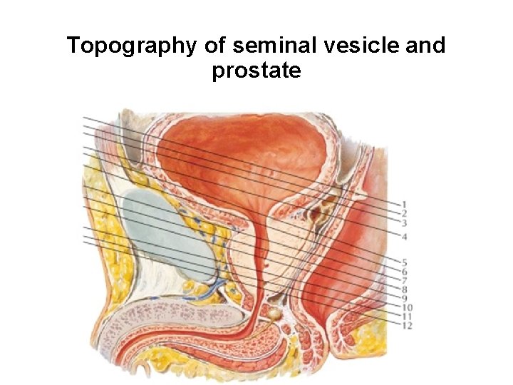 Topography of seminal vesicle and prostate 