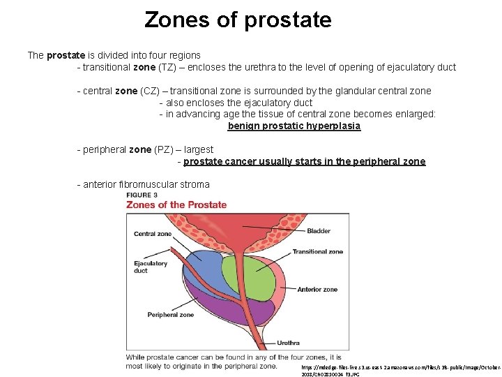 Zones of prostate The prostate is divided into four regions - transitional zone (TZ)