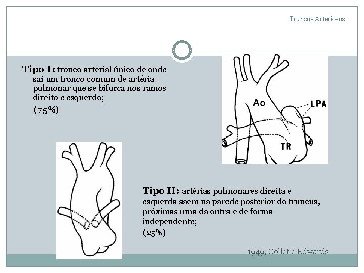 Truncus Arteriosus Tipo I: tronco arterial único de onde sai um tronco comum de