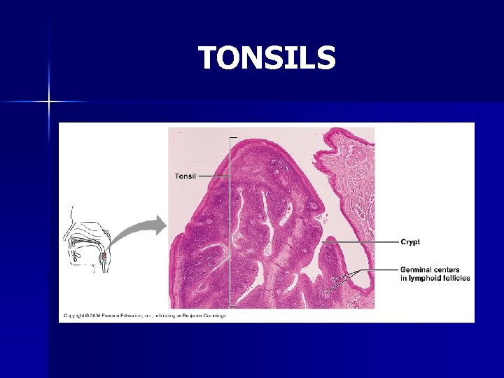 TONSILS 