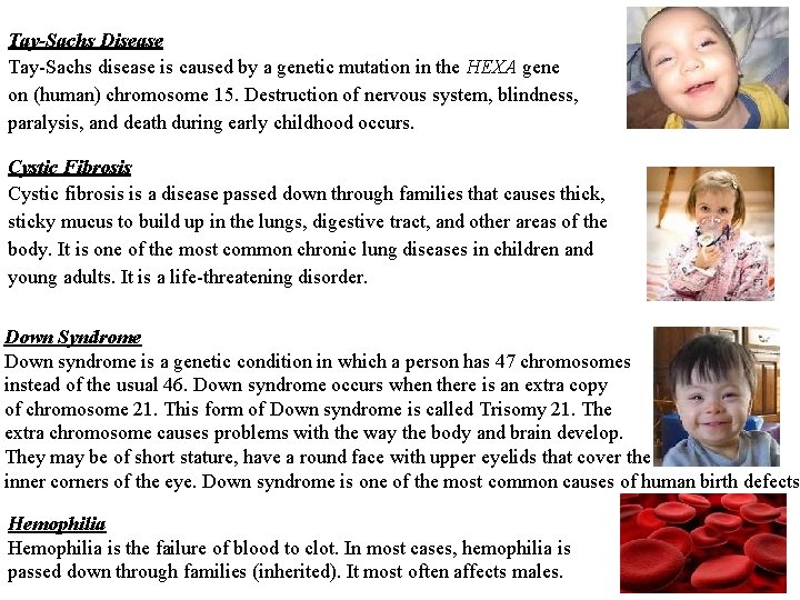 Tay-Sachs Disease Tay-Sachs disease is caused by a genetic mutation in the HEXA gene