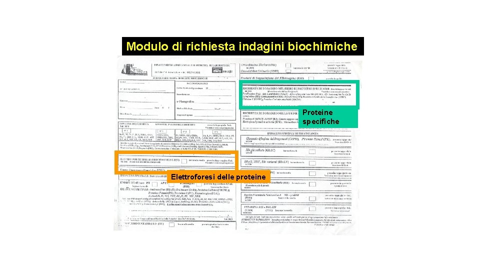 Modulo di richiesta indagini biochimiche Proteine specifiche Elettroforesi delle proteine 