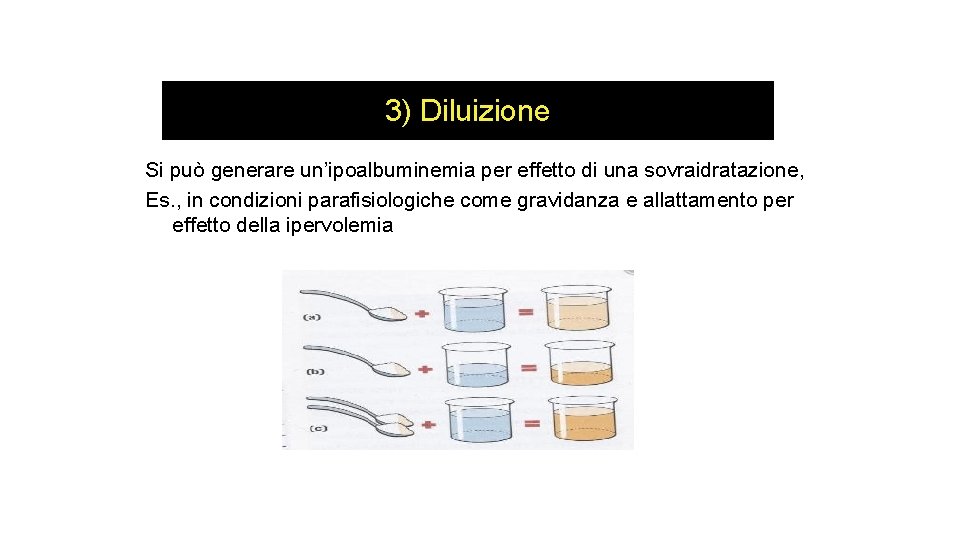 3) Diluizione Si può generare un’ipoalbuminemia per effetto di una sovraidratazione, Es. , in