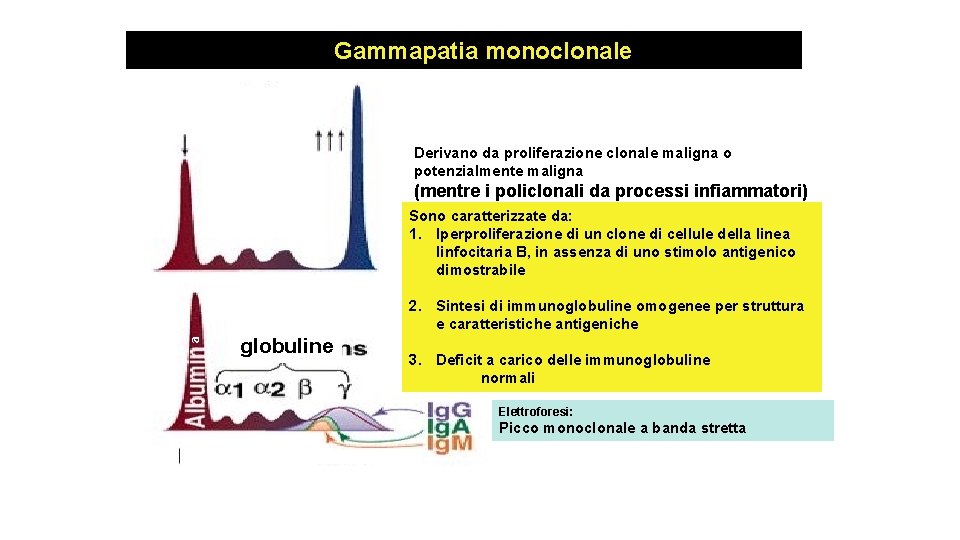 Gammapatia monoclonale Derivano da proliferazione clonale maligna o potenzialmente maligna (mentre i policlonali da