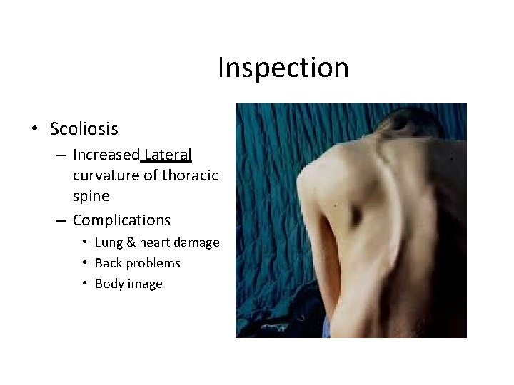 Inspection • Scoliosis – Increased Lateral curvature of thoracic spine – Complications • Lung