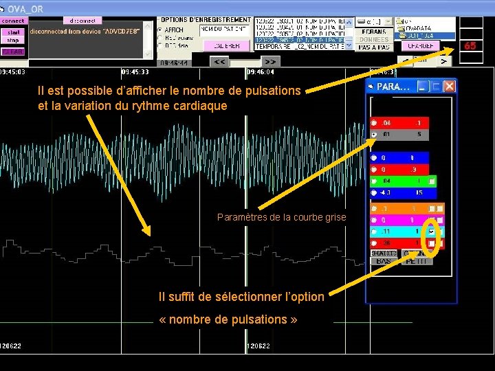 Il est possible d’afficher le nombre de pulsations et la variation du rythme cardiaque