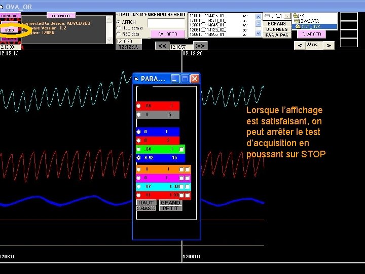 Lorsque l’affichage est satisfaisant, on peut arrêter le test d’acquisition en poussant sur STOP