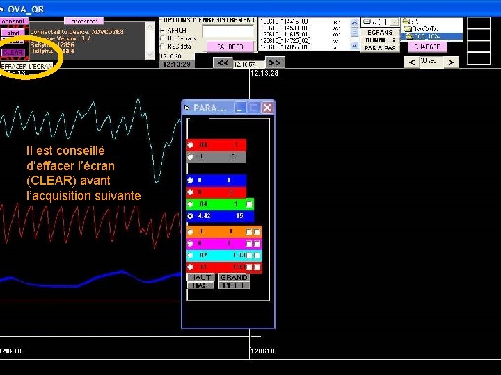 Il est conseillé d’effacer l’écran (CLEAR) avant l’acquisition suivante 