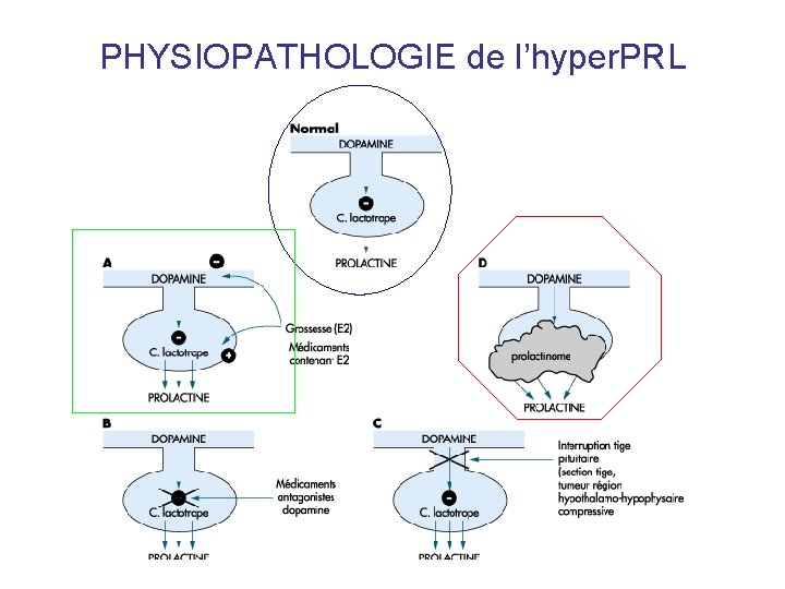 PHYSIOPATHOLOGIE de l’hyper. PRL PHYSIOPATHOLOGIE de l’hyper. PRL