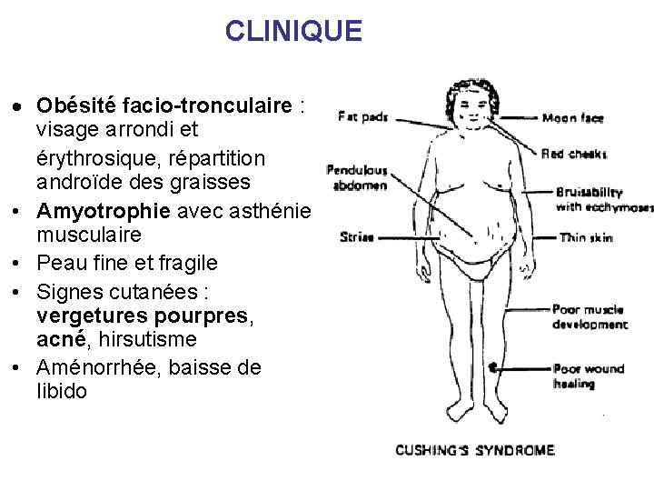 CLINIQUE Obésité facio-tronculaire : visage arrondi et érythrosique, répartition androïde des graisses • Amyotrophie CLINIQUE Obésité facio-tronculaire : visage arrondi et érythrosique, répartition androïde des graisses • Amyotrophie