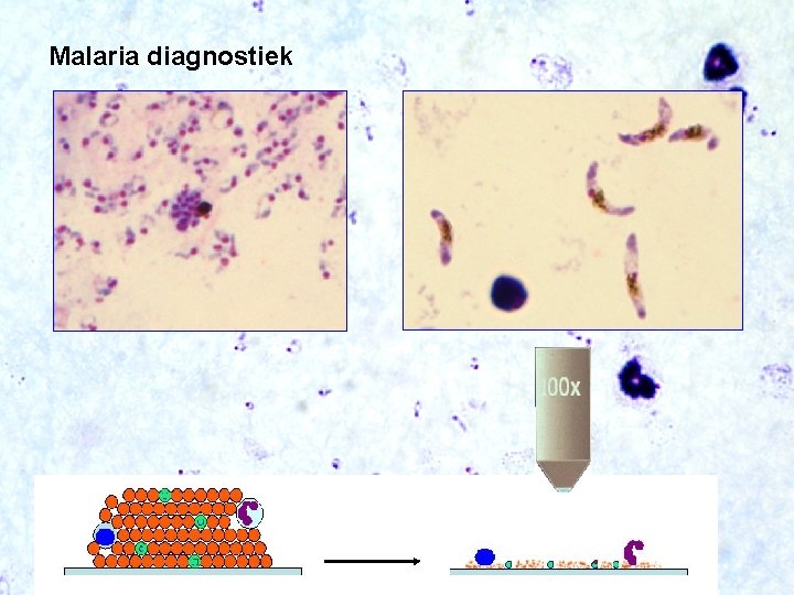 Malaria diagnostiek 