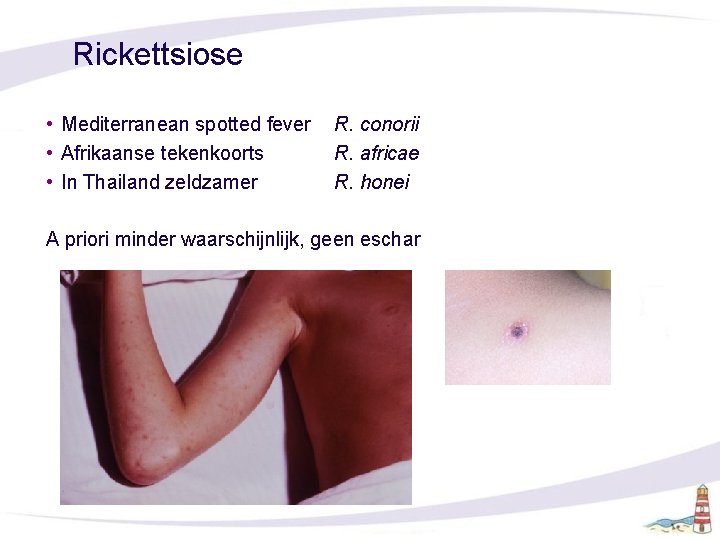 Rickettsiose • Mediterranean spotted fever • Afrikaanse tekenkoorts • In Thailand zeldzamer R. conorii