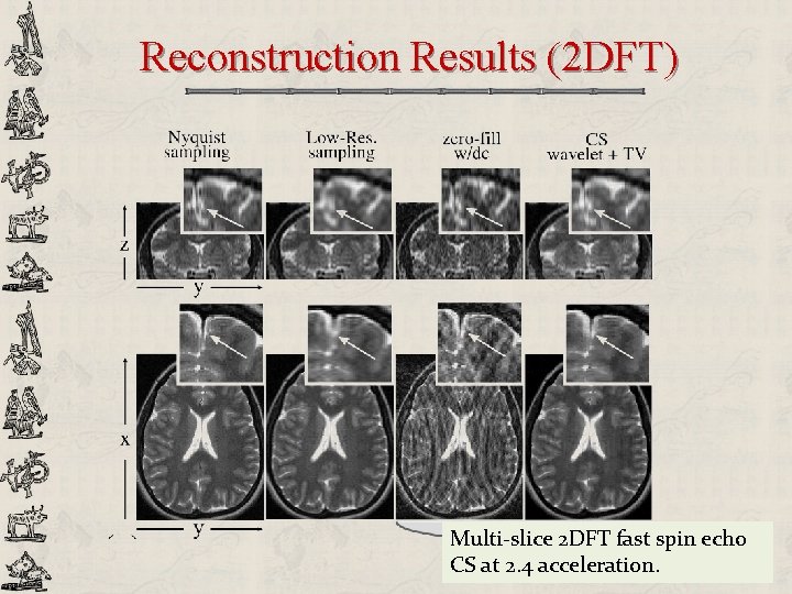 Reconstruction Results (2 DFT) Multi-slice 2 DFT fast spin echo CS at 2. 4