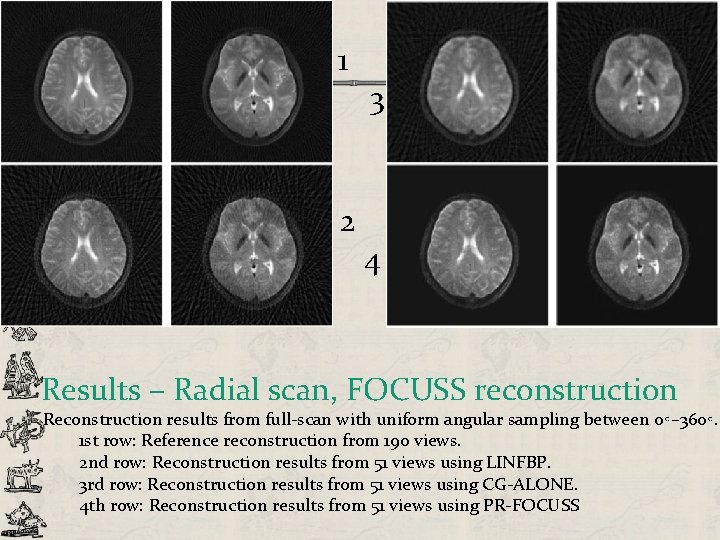 1 2 3 4 Results – Radial scan, FOCUSS reconstruction Reconstruction results from full-scan