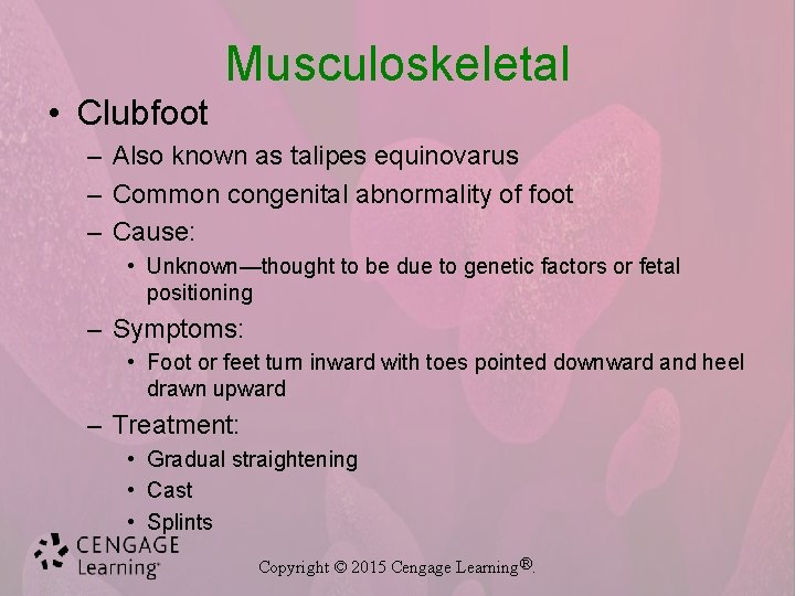 Musculoskeletal • Clubfoot – Also known as talipes equinovarus – Common congenital abnormality of