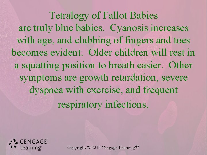 Tetralogy of Fallot Babies are truly blue babies. Cyanosis increases with age, and clubbing