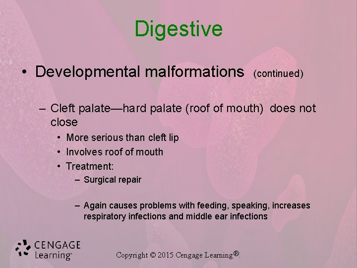 Digestive • Developmental malformations (continued) – Cleft palate—hard palate (roof of mouth) does not