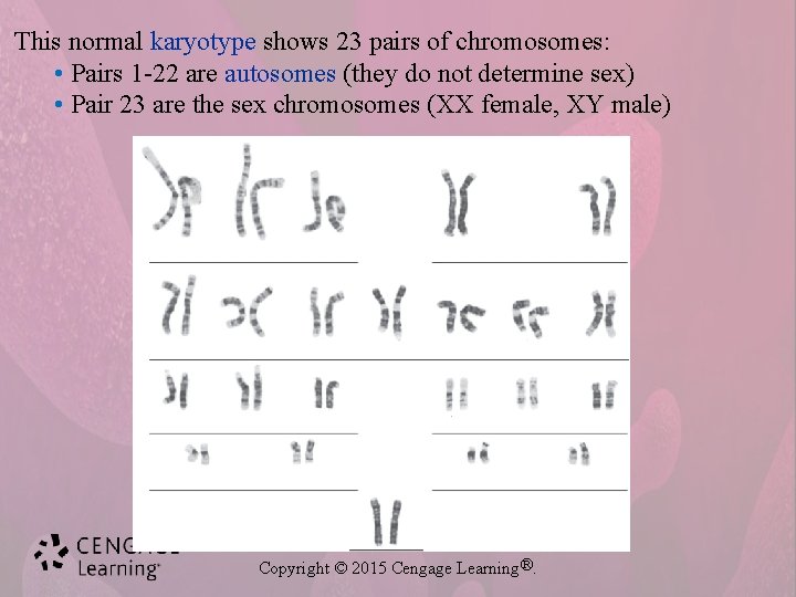 This normal karyotype shows 23 pairs of chromosomes: • Pairs 1 -22 are autosomes