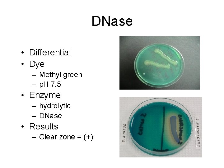 DNase • Differential • Dye – Methyl green – p. H 7. 5 •