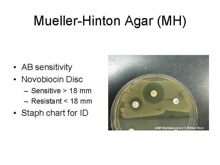 Mueller-Hinton Agar (MH) • AB sensitivity • Novobiocin Disc – Sensitive > 18 mm