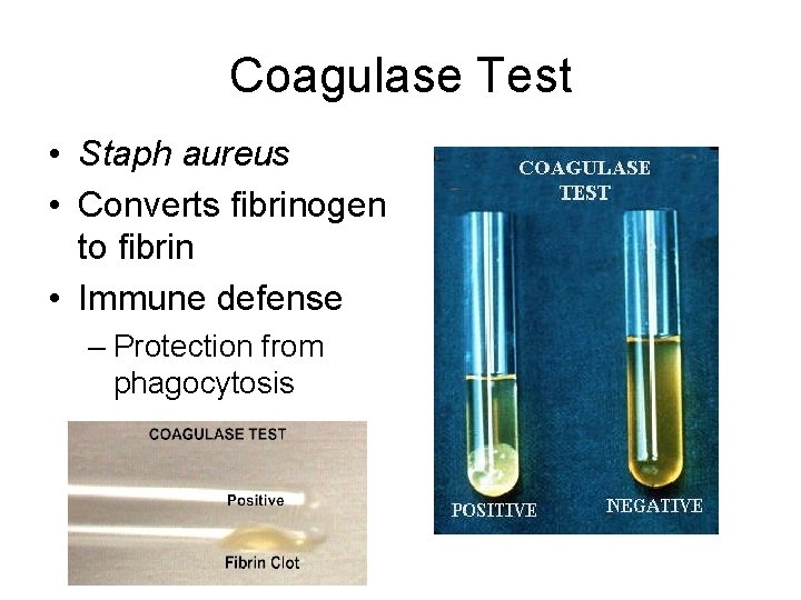 Coagulase Test • Staph aureus • Converts fibrinogen to fibrin • Immune defense –