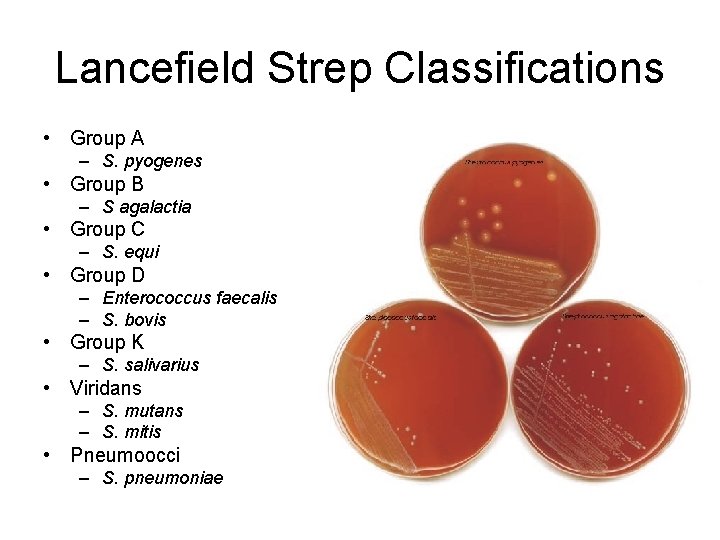 Lancefield Strep Classifications • Group A – S. pyogenes • Group B – S