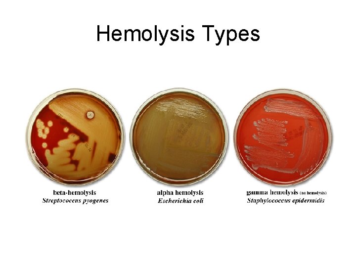 Hemolysis Types 