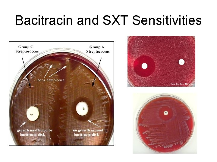 Bacitracin and SXT Sensitivities 