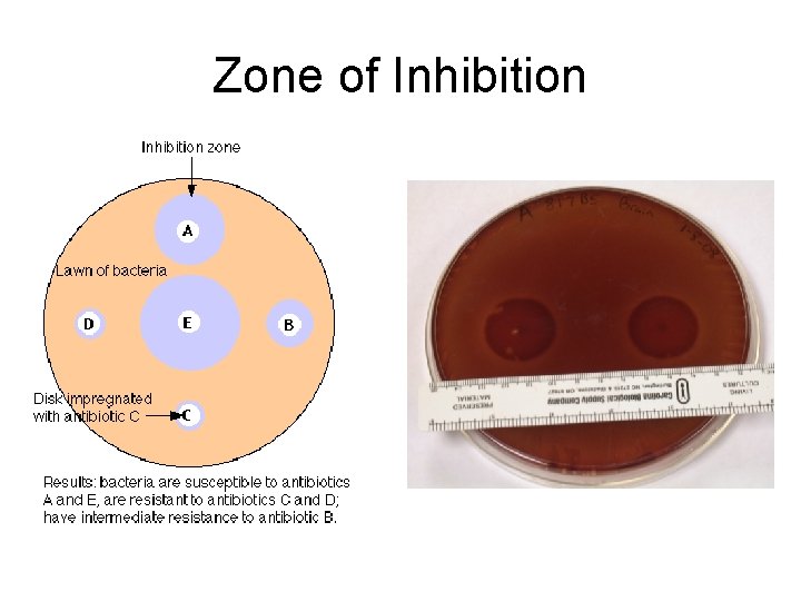 Zone of Inhibition 