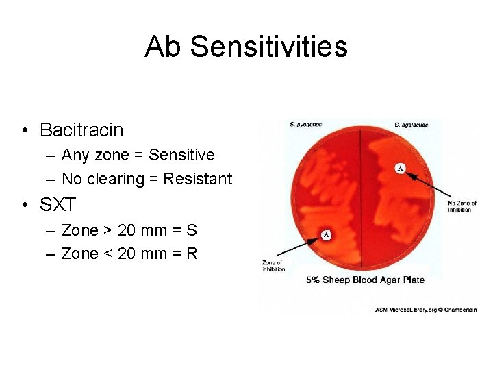 Ab Sensitivities • Bacitracin – Any zone = Sensitive – No clearing = Resistant